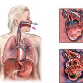 Пневмония – воспаление лёгких